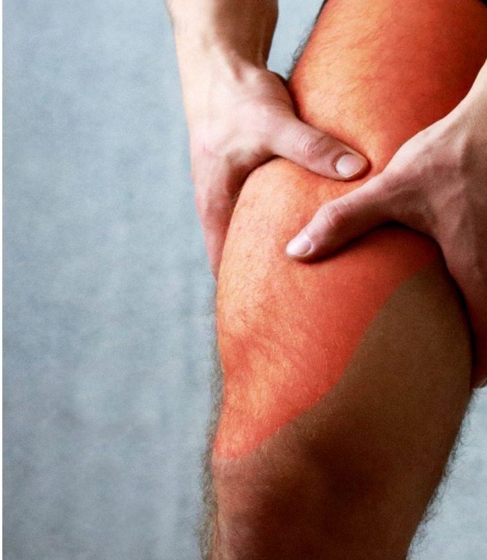 Homme tenant sa cuisse avec les deux mains, une zone rougeoyant indique une douleur musculaire, illustrant les tensions localisées que le shiatsu peut soulager efficacement - Cabinet Terre de Shiatsu Lyon 5e